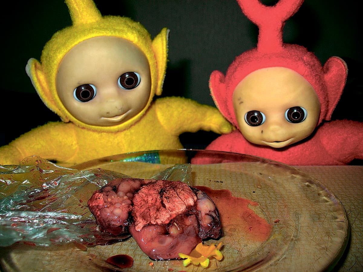 ТБ вбиває тебе